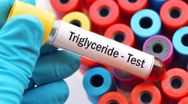 ¿Triglicéridos altos? Lo que comés y lo que hacés no siempre alcanza